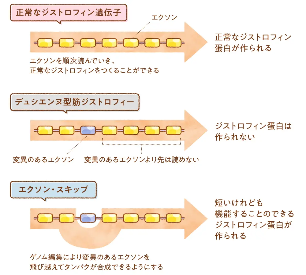 デュシャンヌ型筋ジストロフィーに対するゲノム編集