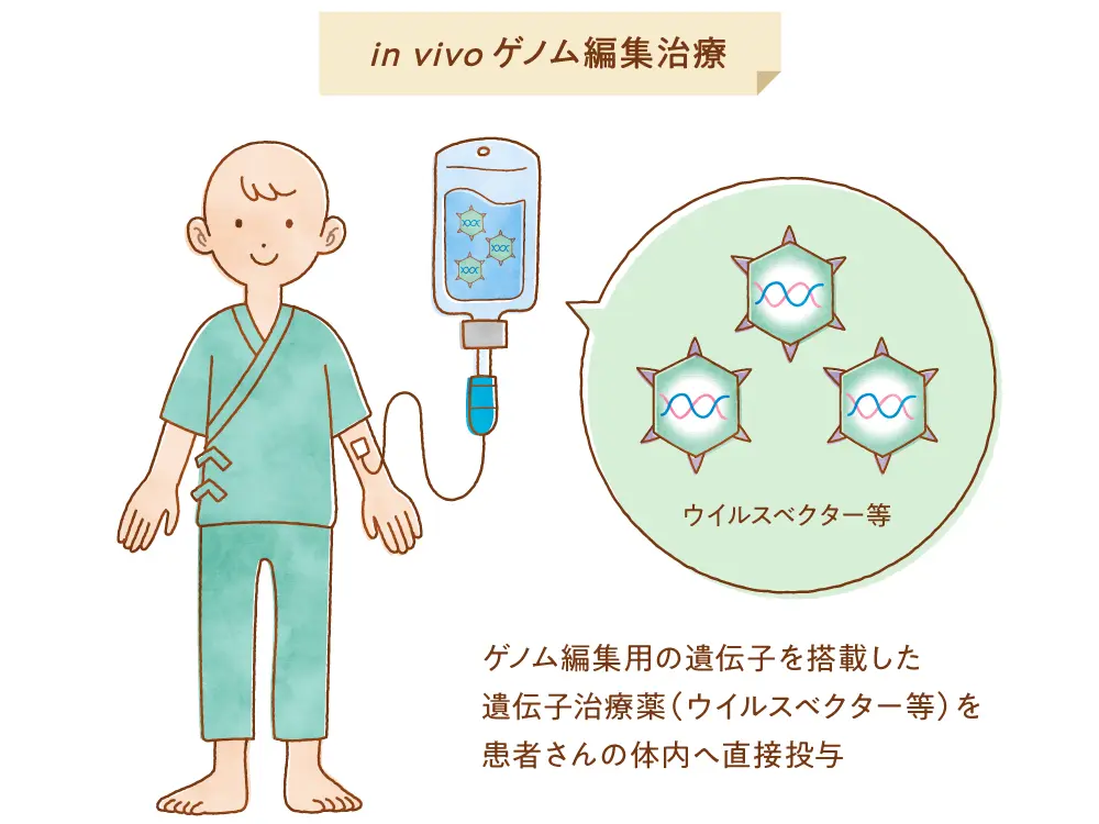 体内(in vivo)ゲノム編集と体外(ex vivo)ゲノム編集